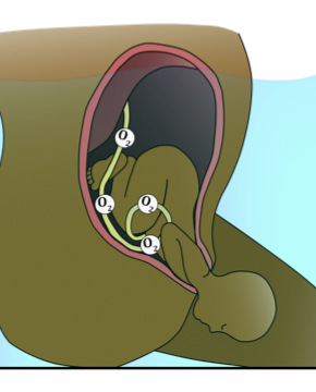 The next picture shows the same baby being born still receiving oxygen from their umbilical cord.